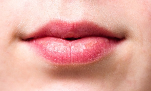 Homemade Beauty Tips For Dry and Chapped Lips