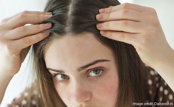 How to Get Rid of White Hair in Teenagers and Young Adult
