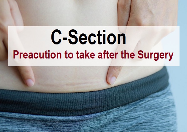 What Not to Do After C-Section (Cesarean Delivery)