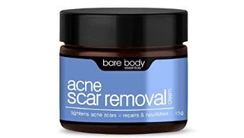 Bare Body Essentials Acne Scar Removal Cream